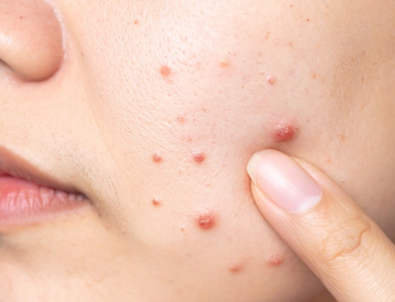 Dermatologist examining a patient's skin during a comprehensive dermatology consultation for skin, hair, and nail health.